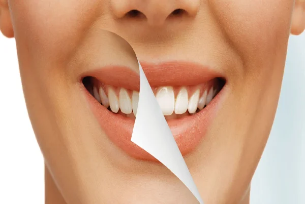 Tooth Polishing